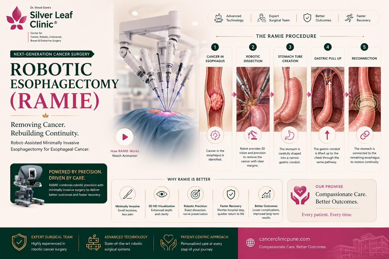 Rectal Cancer Surgery - Dr. Vinod T. Gore
